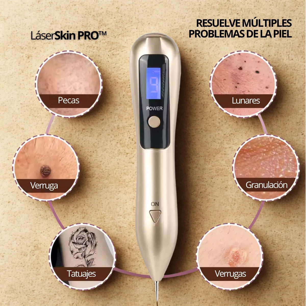 LÁSERSKIN PRO™ CAUTERIZADOR ELIMINA LUNARES, MANCHAS Y VERRUGAS EN SEGUNDOS